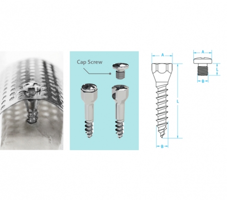 Jeil - Tenting Screw