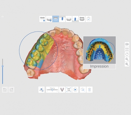 Medit - i700 Wireless Intraoral Scanner