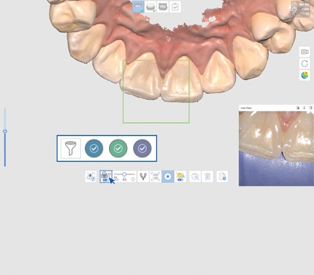 Medit - i700 Wireless Intraoral Scanner