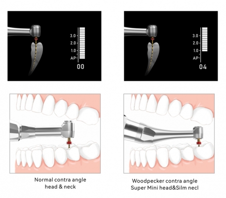 موتور اندو بی سیم Woodpecker - Endo Smart Pro