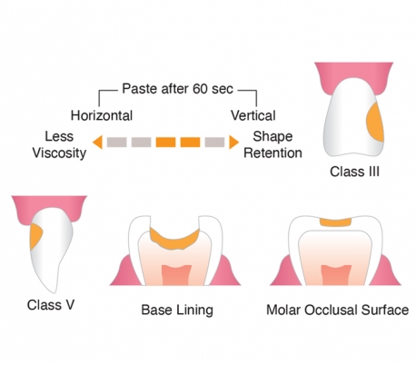 Shofu - Beautifil Injectable XSL Composite