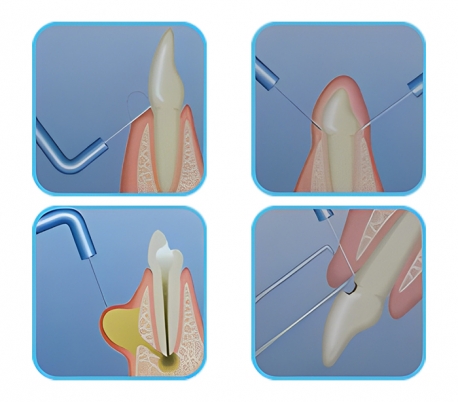 الکتروسرجری DNHmedtech - Actto-50A