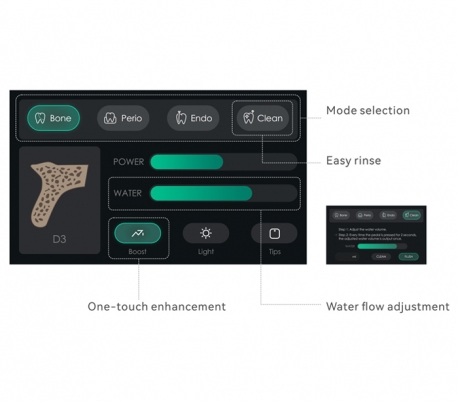 پیزو سرجری نوری نسل چهار Woodpecker - Surgic Smart