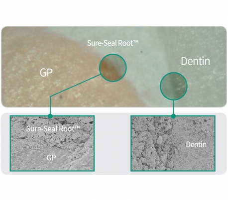 Sure Dent - Sure-Seal Root Bioceramic Sealing Material