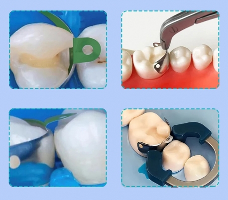 نوار ماتریکس سکشنال سوراخ دار با پوشش تفلون M4 2.0 تک سایز - ZT Dental