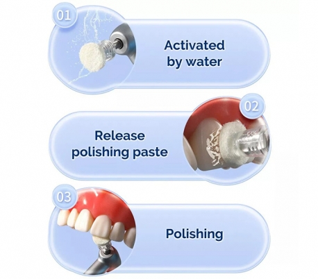 ZT Dental - Paste-Impregnated Polishing Felt Discs