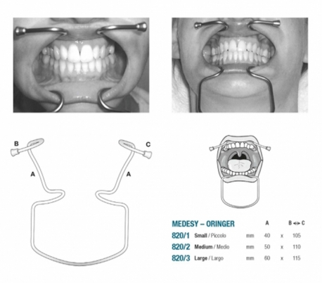 Medesy - Cheek Retractor