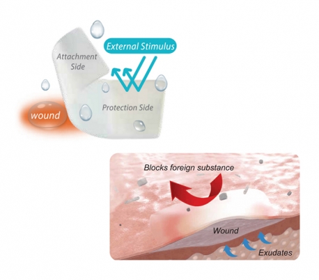 TBM - Ora-Aid Intraoral Wound Dressing