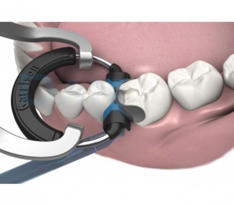 Garrison - Composi-Tight 3D XR