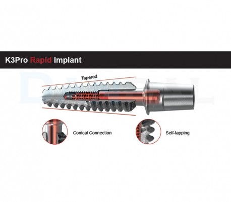 Argon Implant