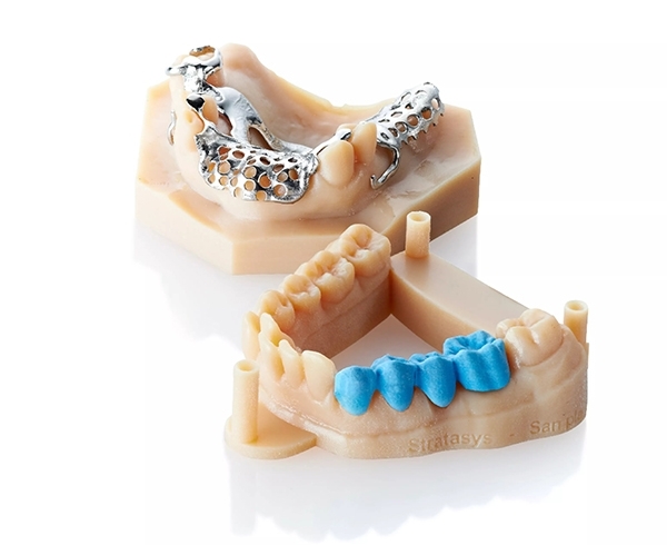 3D printing in dentistry