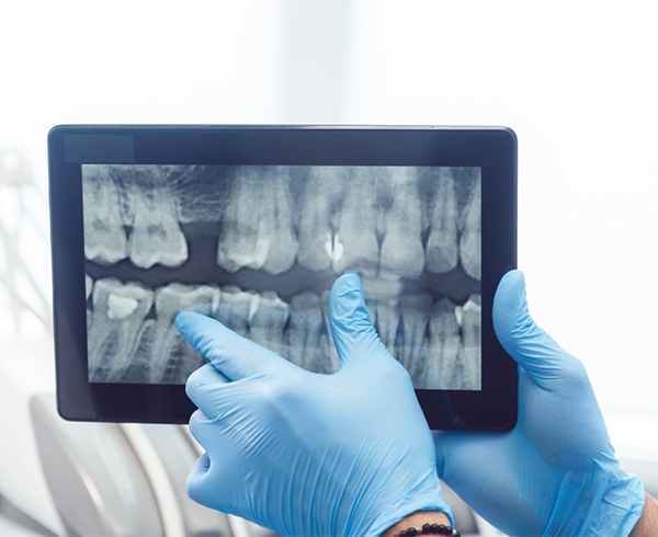 Dental Digital Radiography