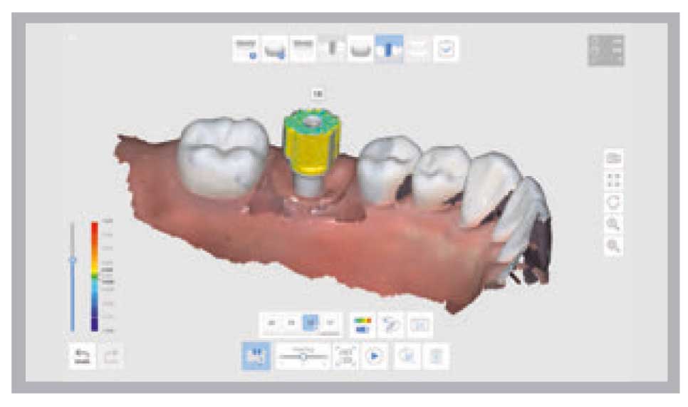 Medit - i500 Intraoral Scanner