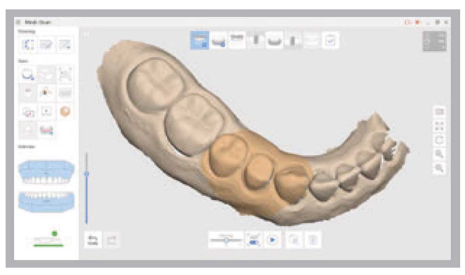 Medit - i500 Intraoral Scanner