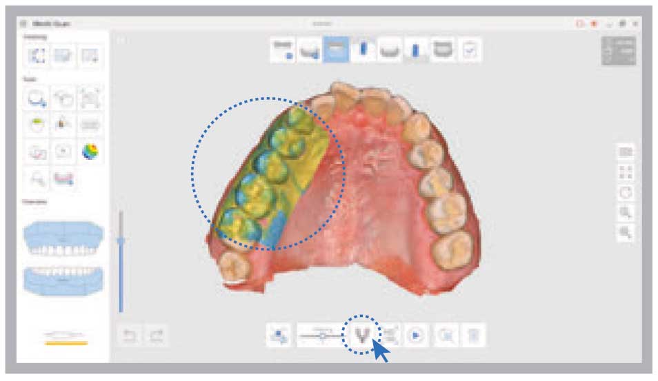 Medit - i500 Intraoral Scanner