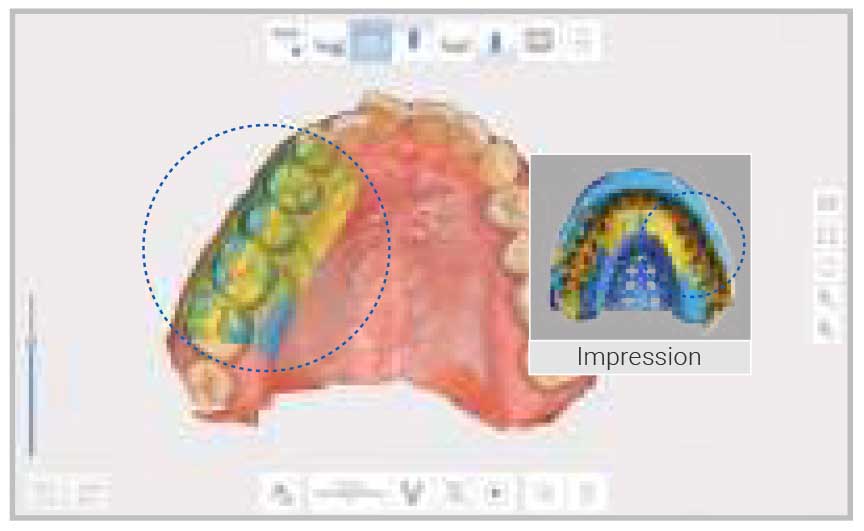 Medit - i700 Intraoral Scanner