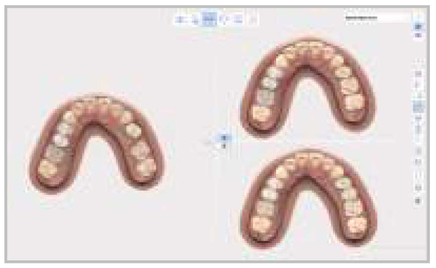 Medit - i700 Intraoral Scanner