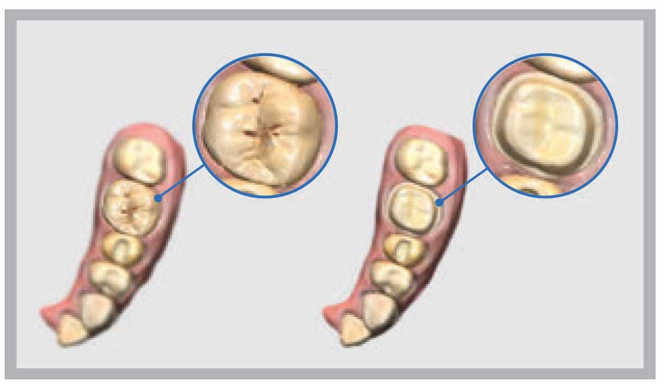 Medit - i500 Intraoral Scanner