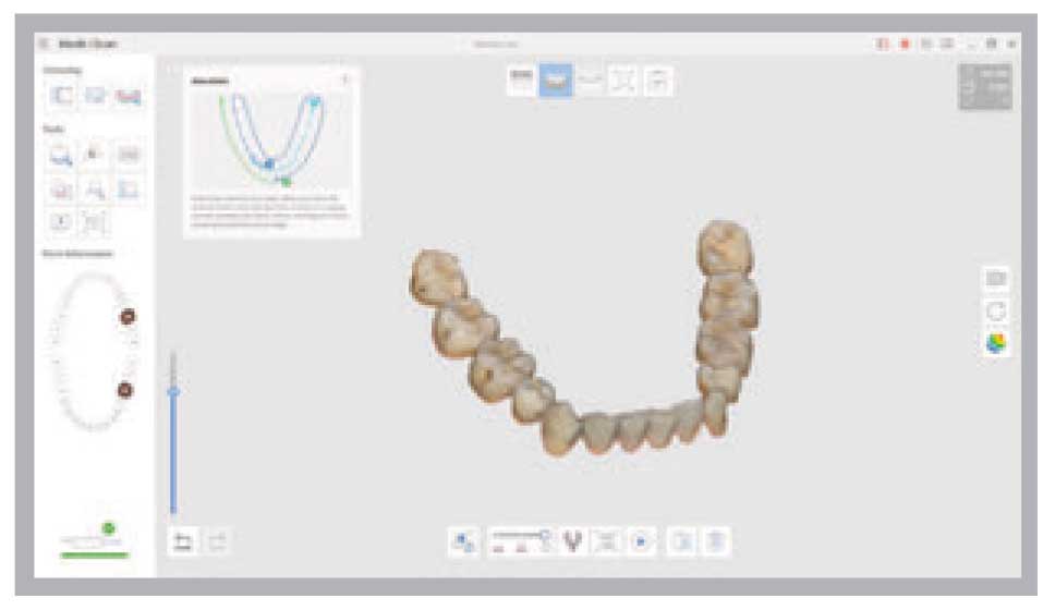 Medit - i500 Intraoral Scanner