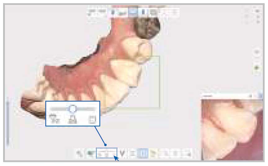 Medit - i700 Intraoral Scanner