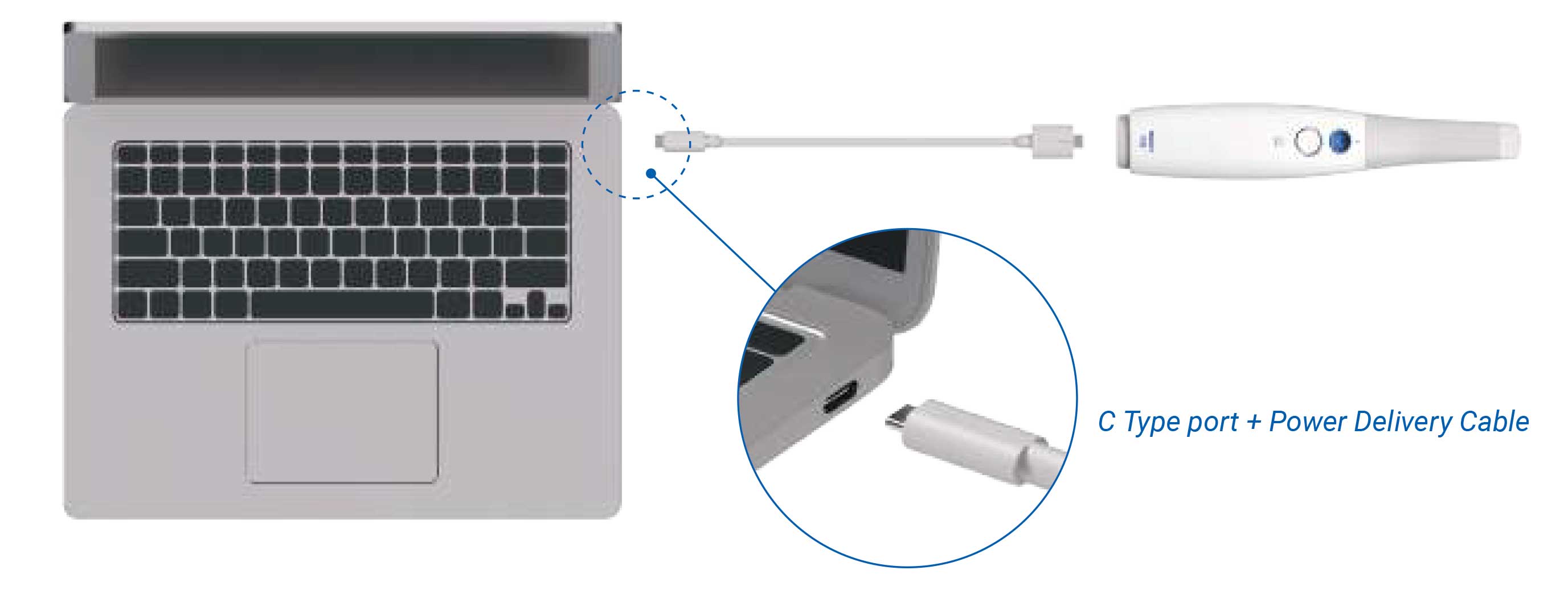 اسکنر داخل دهانی Medit - i700