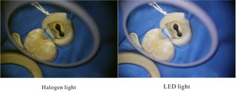 Zumax - OMS2360 Dental Microscope