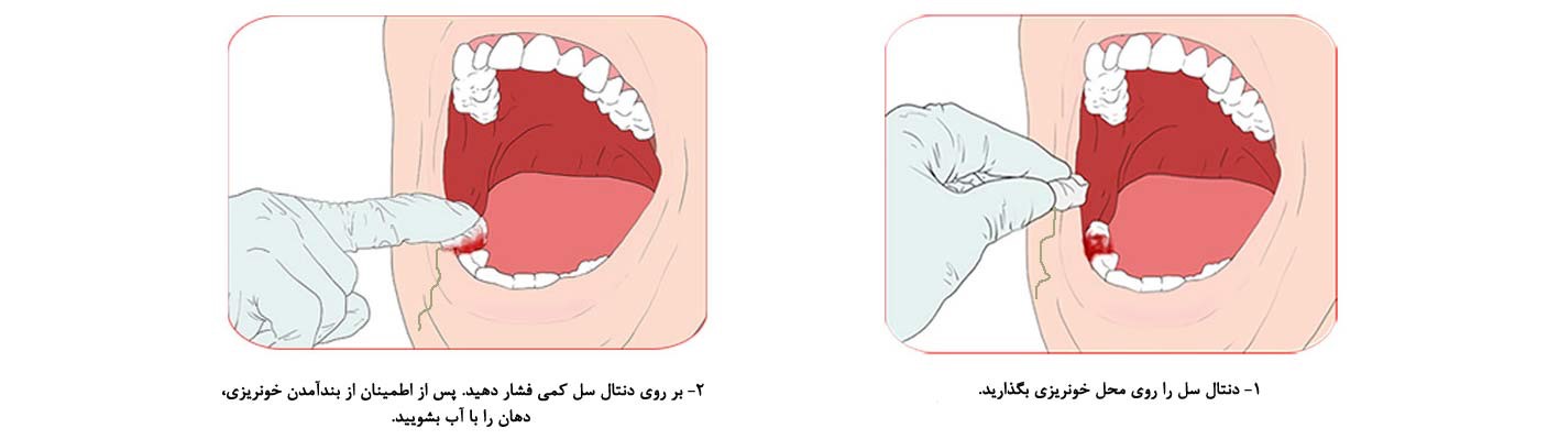 dental cell