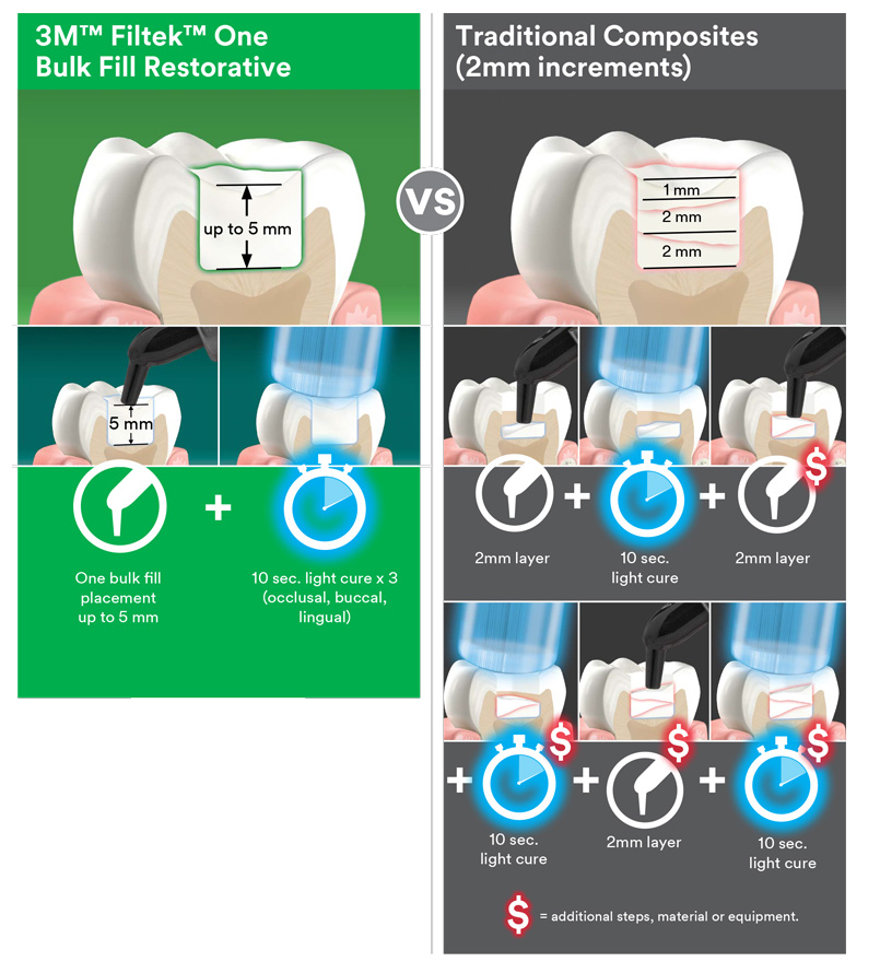 Filtek One Bulk Fill Posterior Restorative