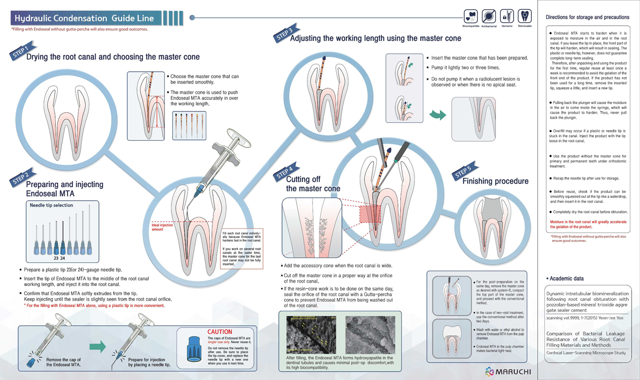 endoseal mta