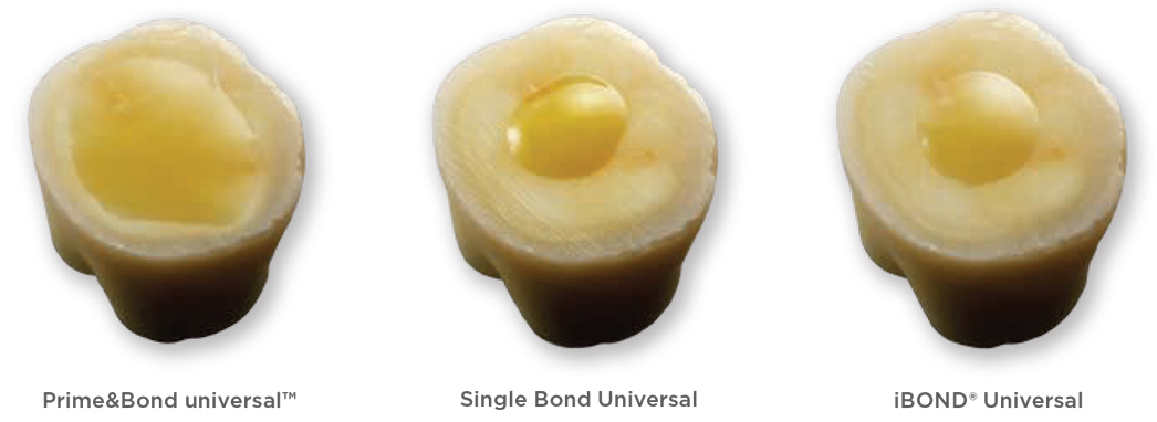 Dentsply Sirona - Prime&Bond universal COMPLETE COVERAGE