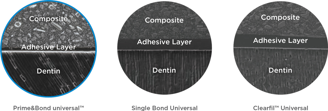 Dentsply Sirona - Prime&Bond Universal film thickness