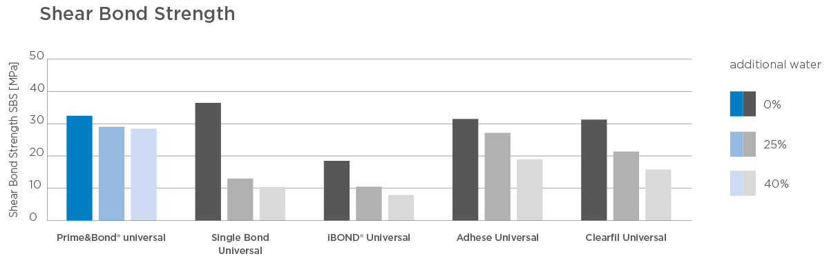 Dentsply Sirona - Prime&Bond universal Bond Strength