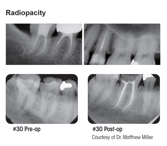 Dia-Root Bio Sealer Radiopacity