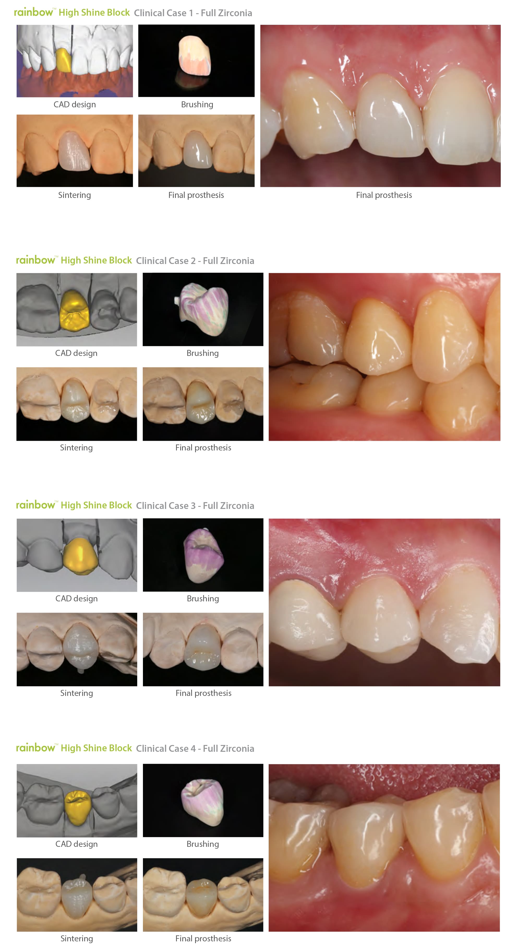 genoss rainbow high shine blocks clinical cases