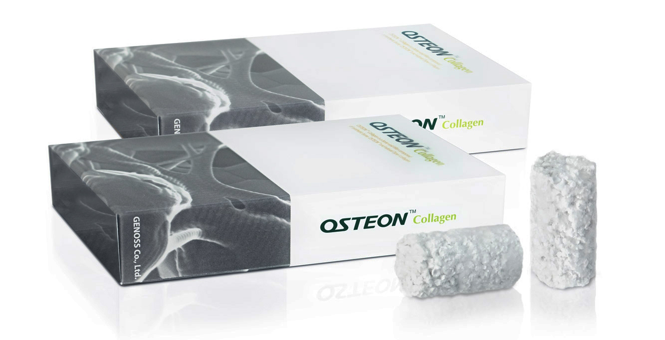 genoss osteon ii collagen