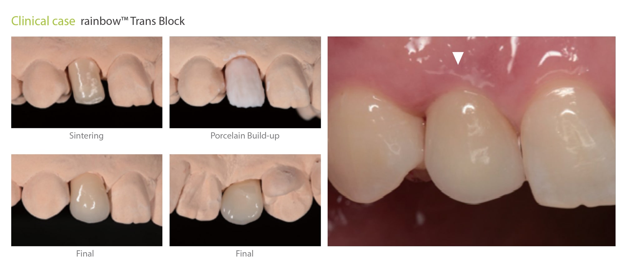 genoss rainbow trans blocks clinical cases