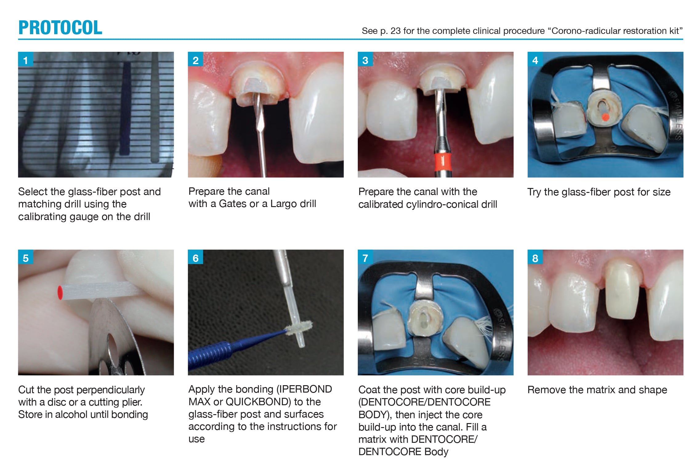 itena dentoclic ivory protocol