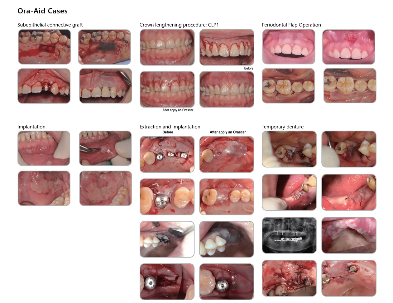 ora-aid cases