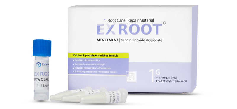 parla ex root mta cement