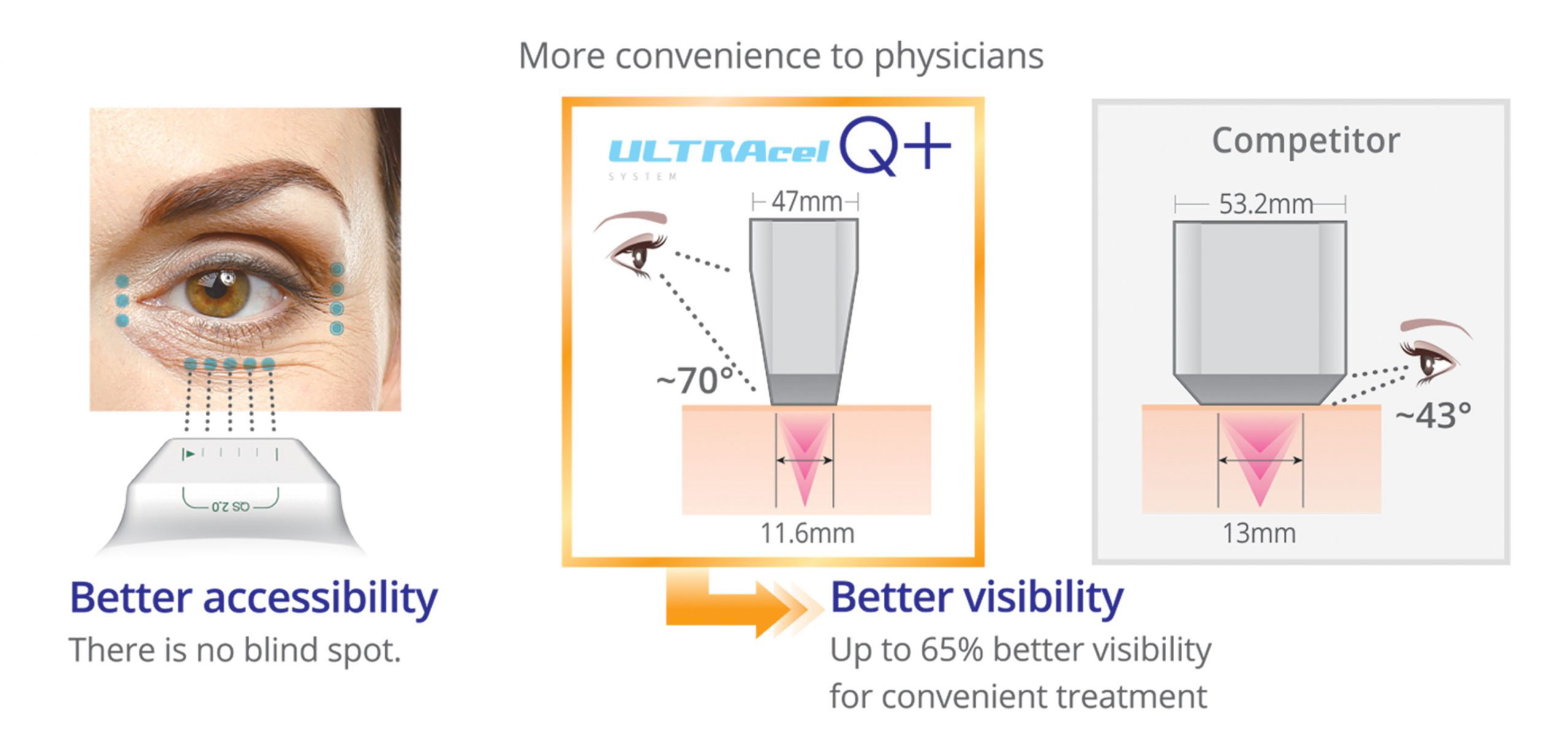 Jeisys - Ultracel Q Plus  Hifu Unit