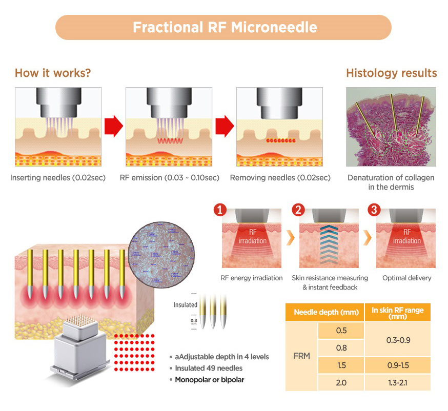 Jeisys - Ultracel  Hifu and RF Contouring Unit