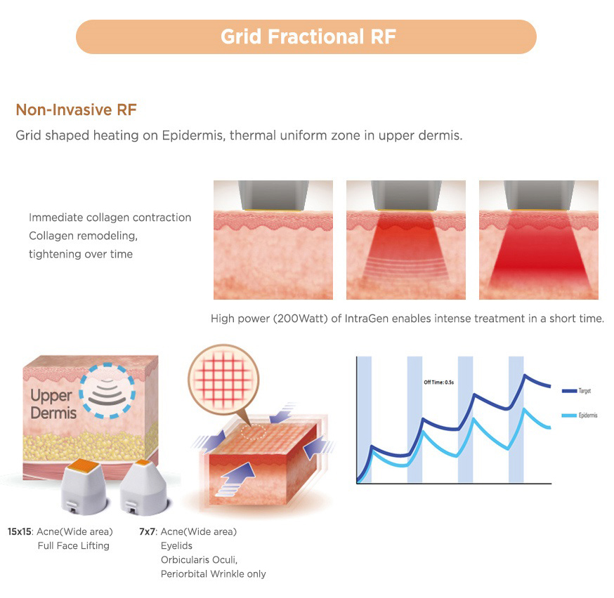 Jeisys - Ultracel  Hifu and RF Contouring Unit