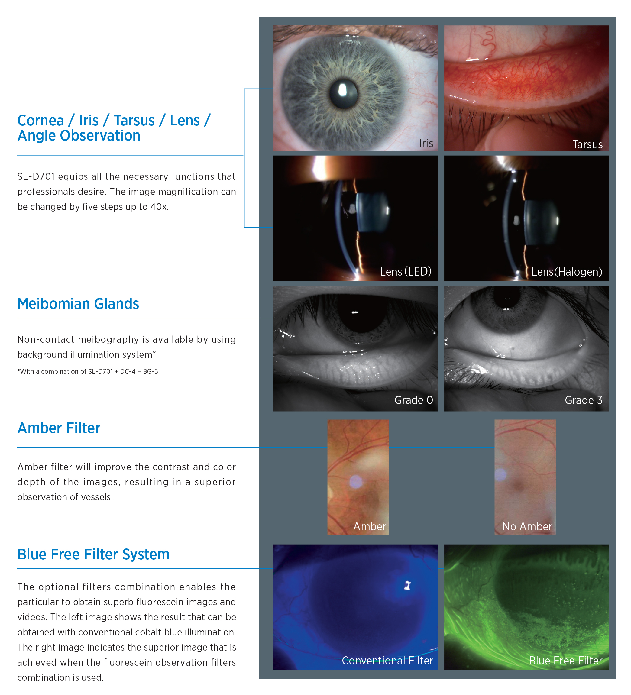 Topcon - SL D701 Slit Lamp