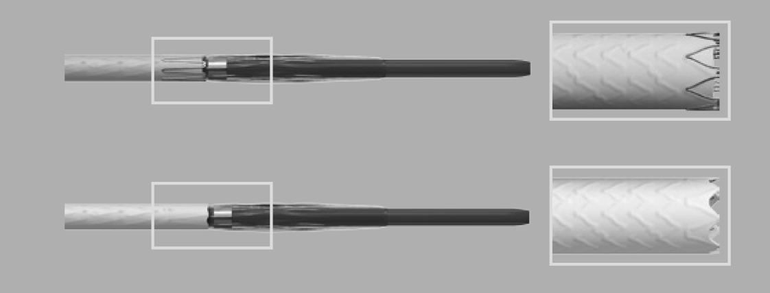 Bentley InnoMed - BeGraft Peripheral Stent Graft