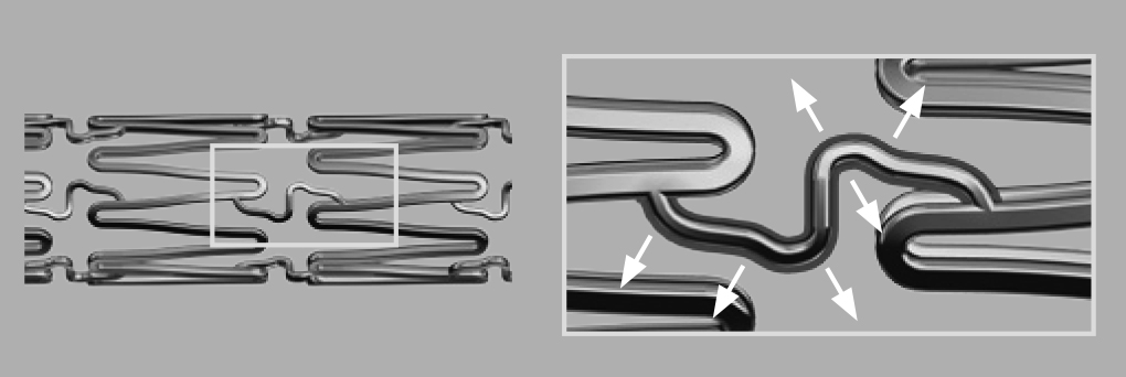 Bentley InnoMed - BeGraft Peripheral Stent Graft