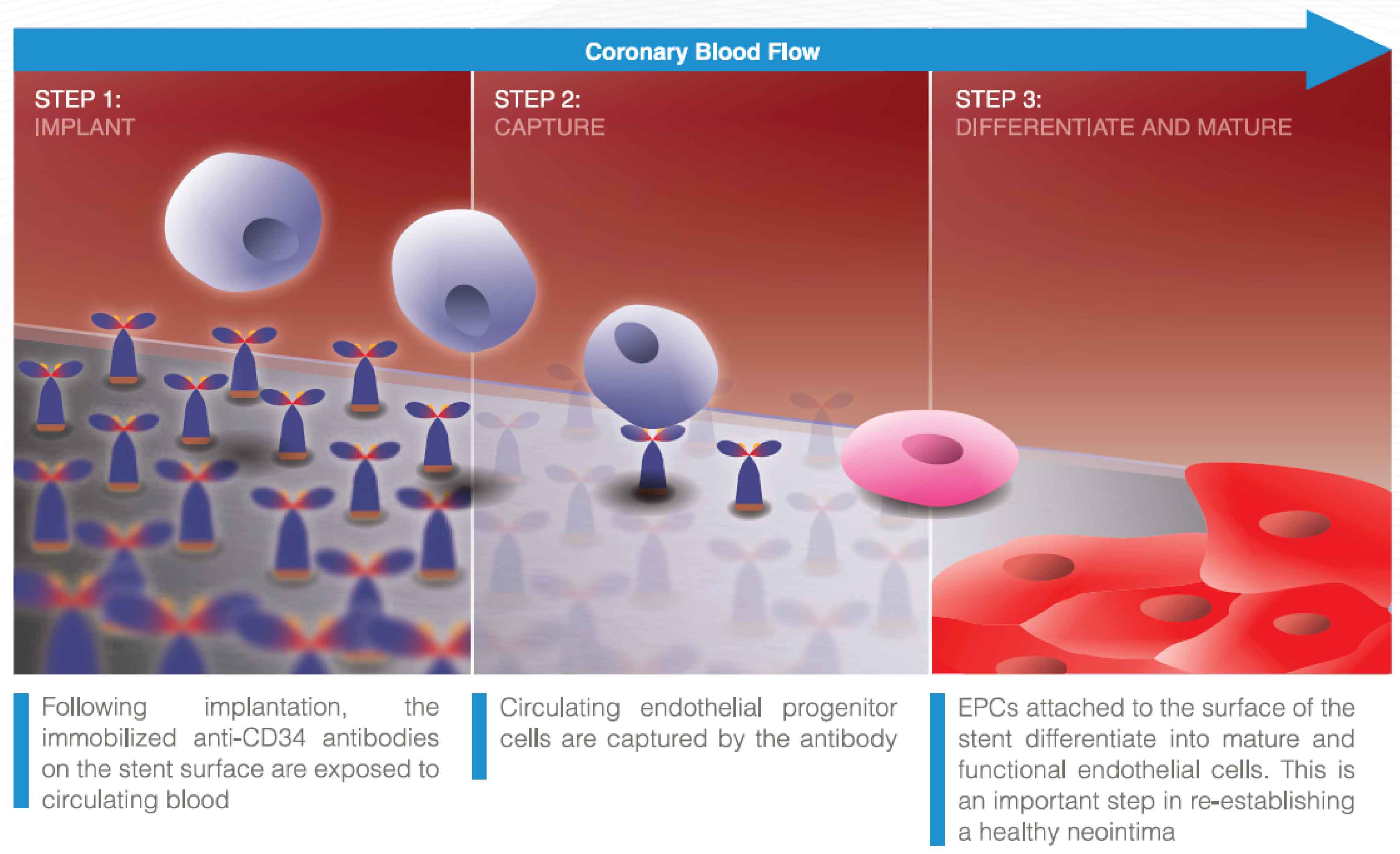 استنت درمان دوگانه OrbusNeich Medical B.V - Combo Plus 