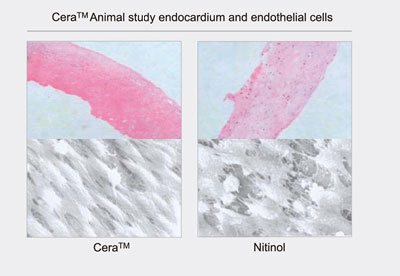 مسدود کننده LifeTech Scientific - Cera ASD