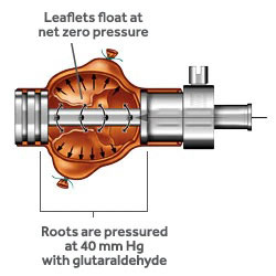 Medtronic - Freestyle  Valve