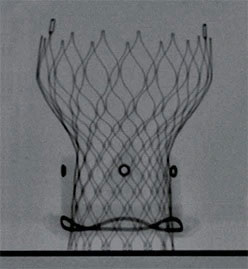 Medtronic - Hancock II Valve