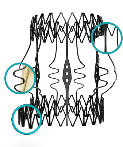 Sorin - Perceval Aortic Heart Valve